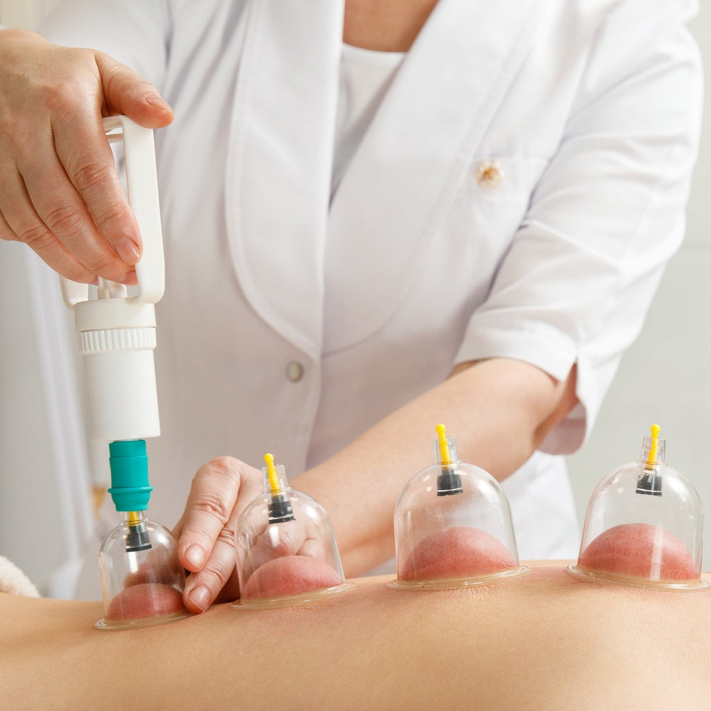 Six different sizes of cupping therapy tools laid out for versatile application.