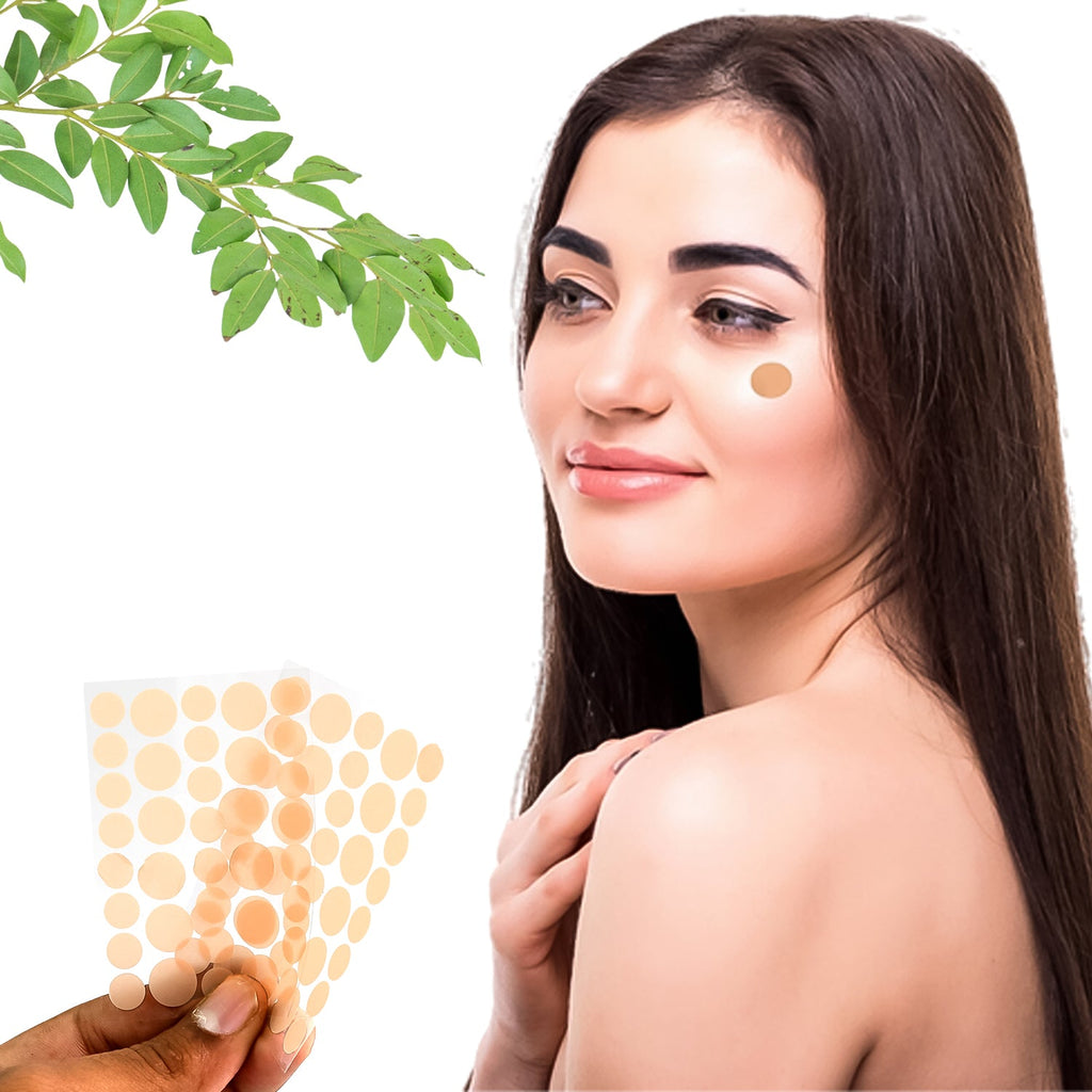 Two GlowForm blemish patches applied on skin to reduce acne inflammation.
