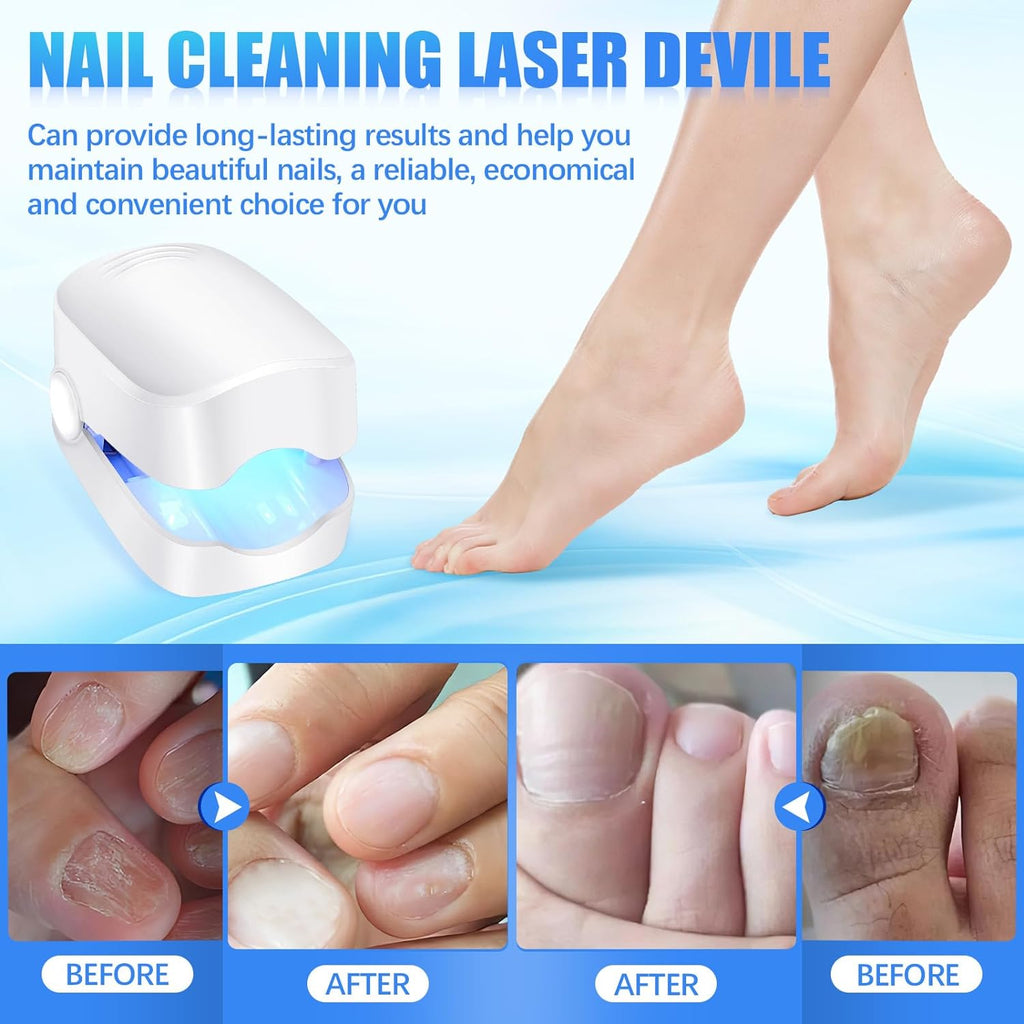 Targeted laser therapy for toenail fungus using the AuriGlam device at home.