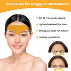 Infographic highlighting benefits of forehead wrinkle patches: reduces lines, smooths skin.