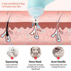 Vacuum Blackhead Remover device held comfortably, showing controls and handle.