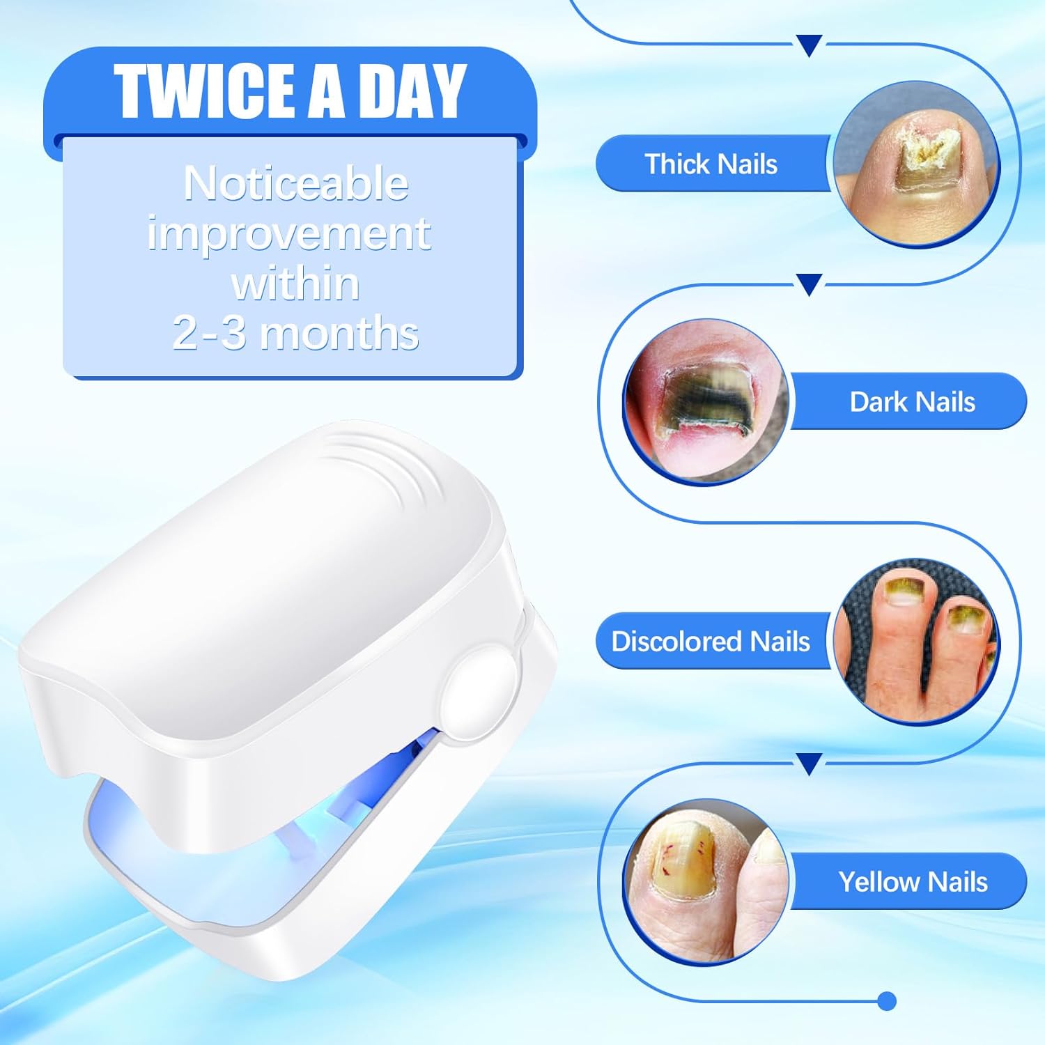 Complete nail care routine featuring the AuriGlam laser treatment device for healthy nails.