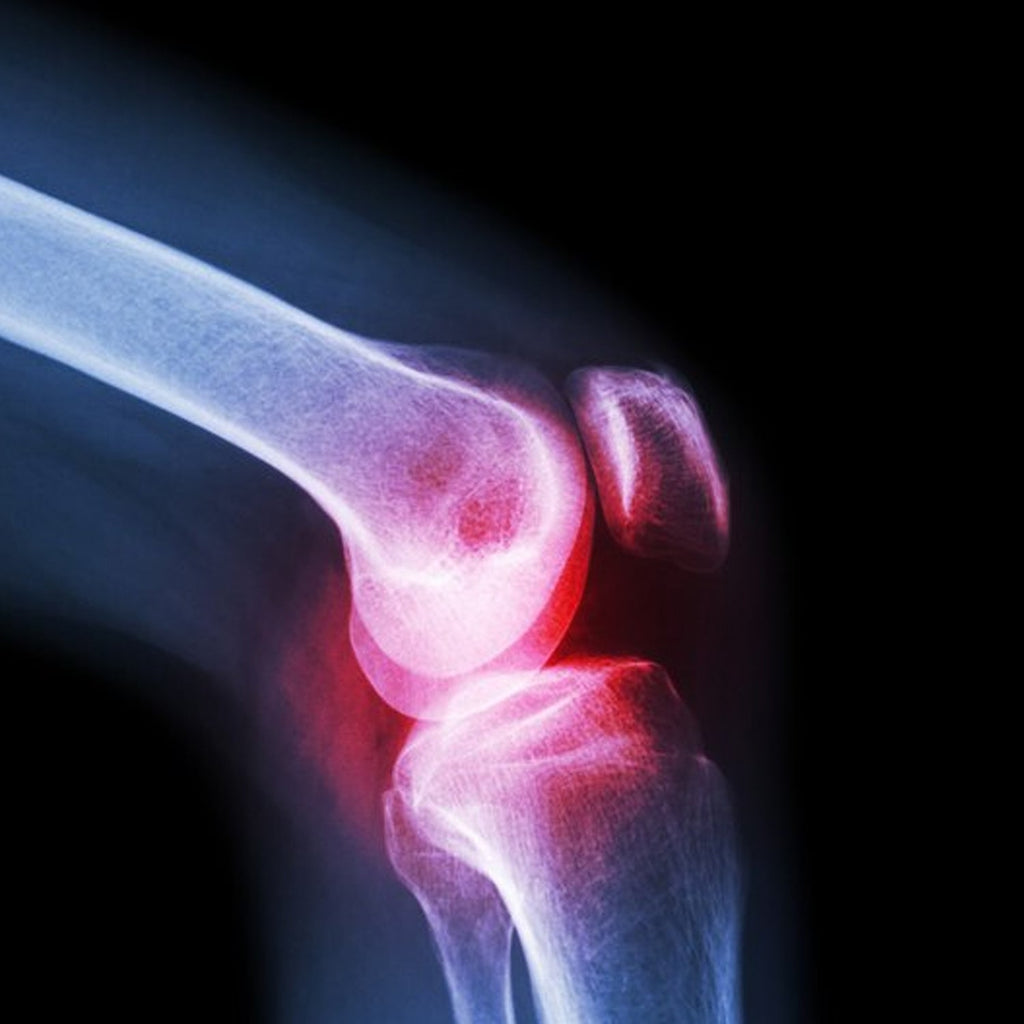 Velvet Wellness Large Knee Cap for Support provides targeted joint support.