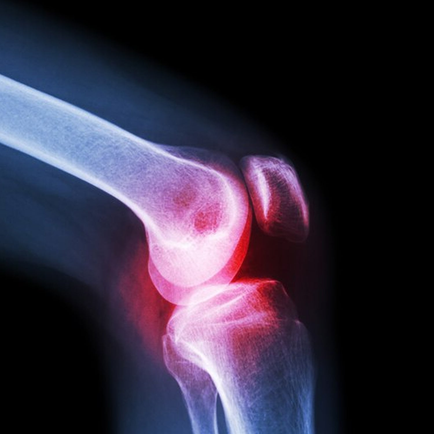 Velvet Wellness Large Knee Cap for Support provides targeted joint support.
