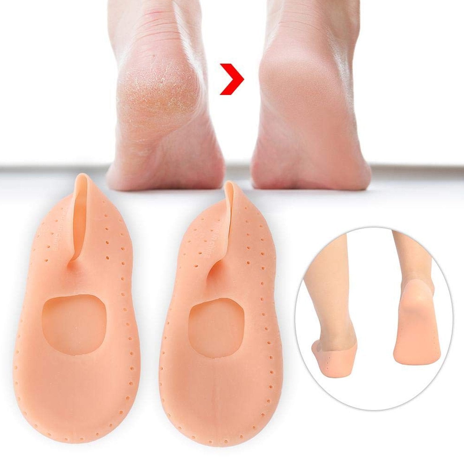 Pair of FitFuzion cracked heel socks, made of transparent silicone gel for foot protection.