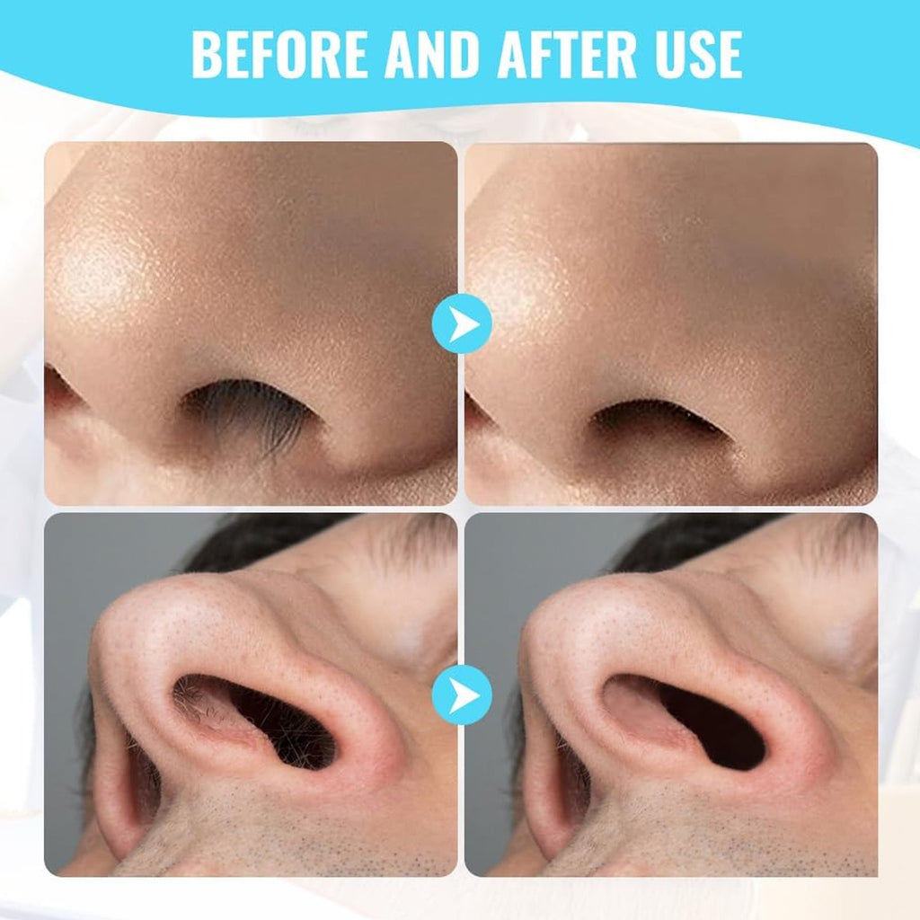All accessories included in the PureBeard nose hair grooming kit.