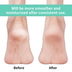 Infographic illustrating key features of the anti-crack silicone heel socks.