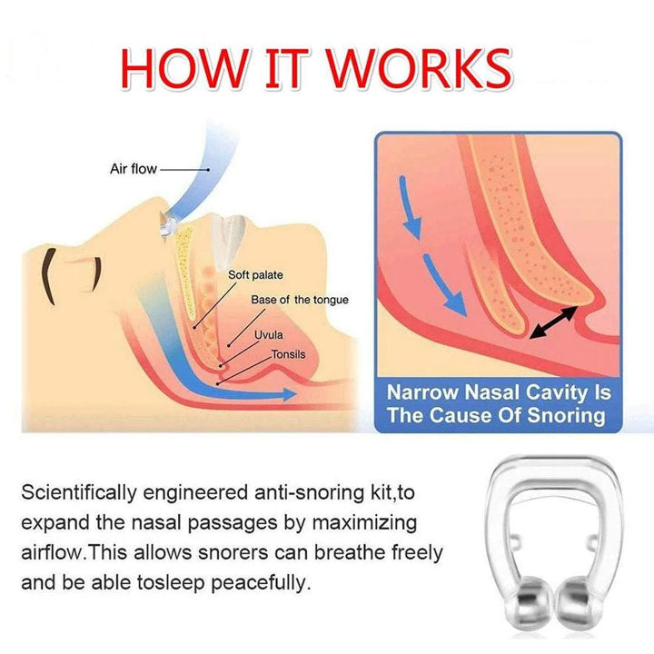 Effective Anti-Snoring Device in use, clearly showing how it aids snore reduction.