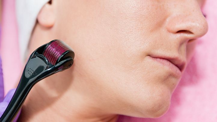 Effective skin treatment with a derma roller for a radiant and youthful complexion.